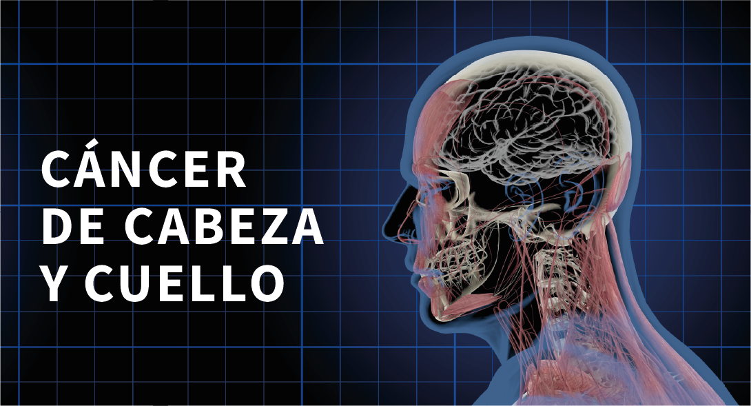 Cáncer de cabeza y cuello